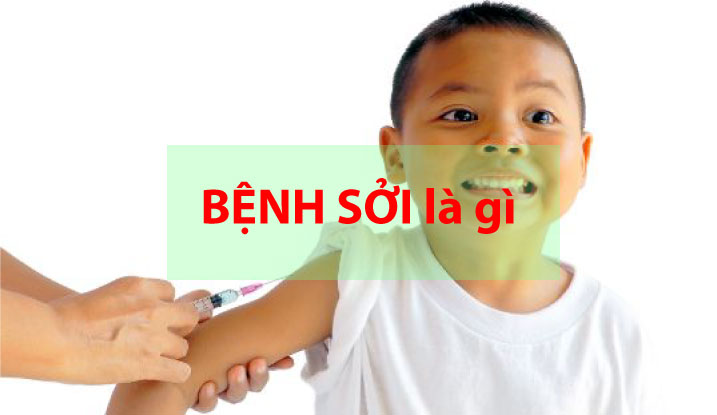 Bệnh sởi là gì