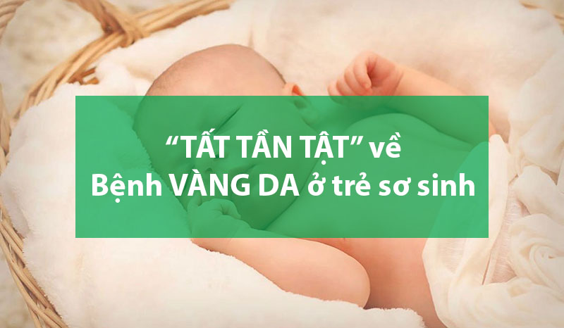 Bệnh vàng da ở trẻ sơ sinh: Nguyên nhân, dấu hiệu, tác hại, cách điều trị
