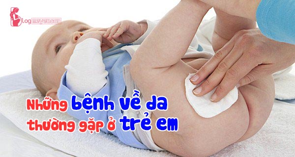 Những bệnh về da thường gặp ở trẻ em