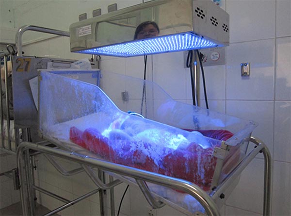 Trẻ được chữa vàng da bằng phương pháp quang trị liệu Trẻ được chữa vàng da bằng phương pháp quang trị liệu