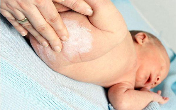 Phấn rôm cho hại cho da em bé không?