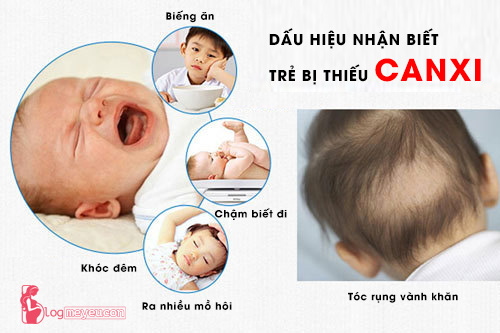 Dấu hiệu nhận biết trẻ bị thiếu Canxi