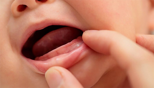 Trẻ sẽ chậm mọc răng vì thiếu Canxi